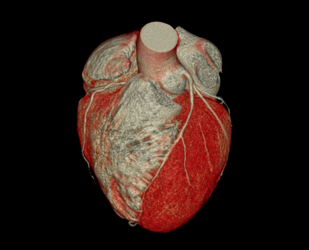 Broken-Heart-Syndrom – Wenn das Herz auf Stress reagiert